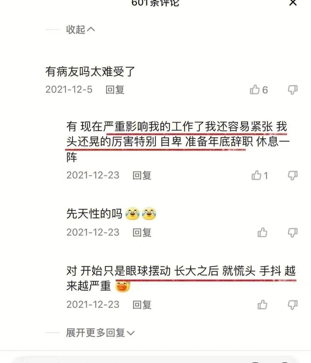 眼球不自主的摆动当心眼球震颤