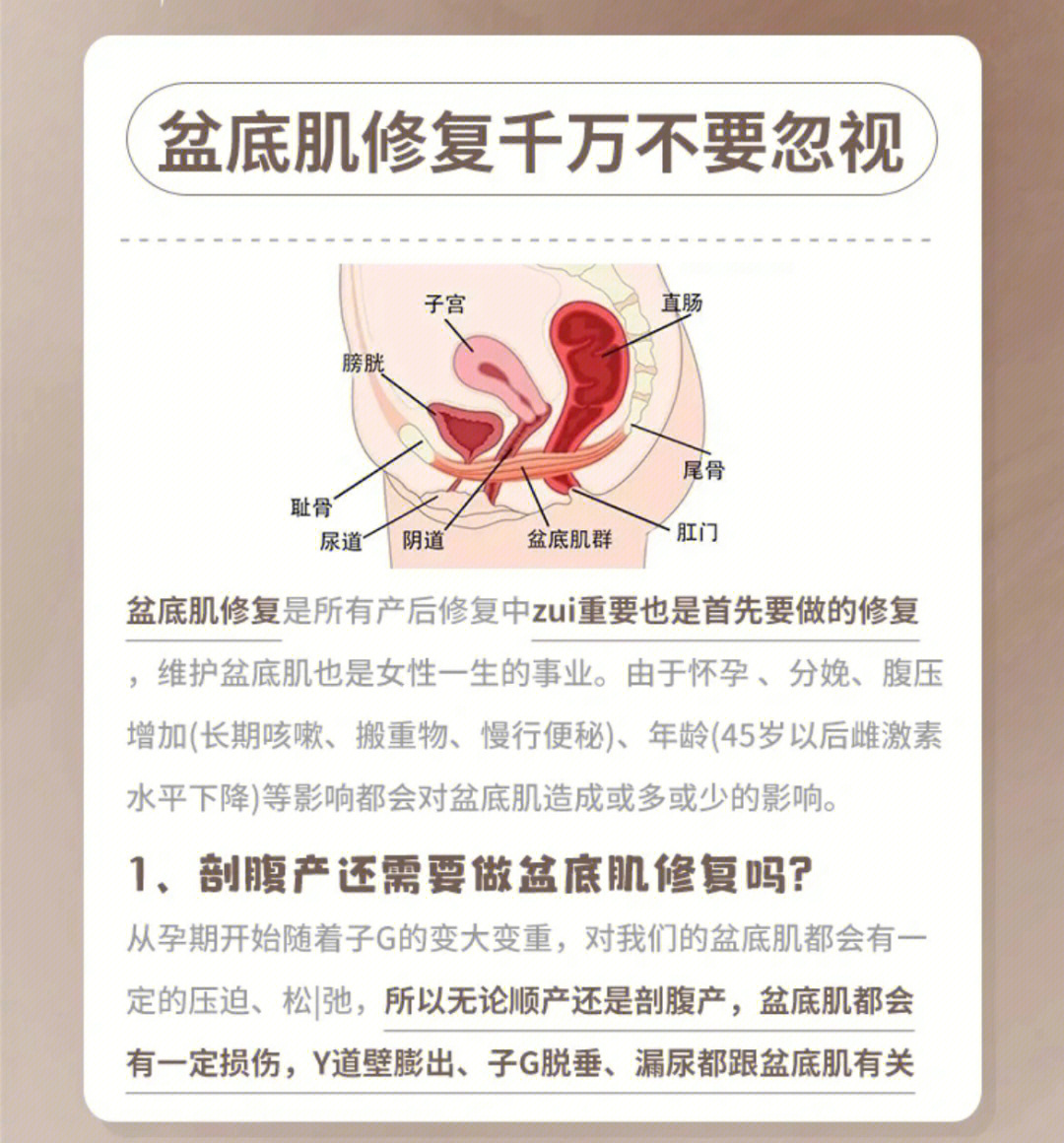 盆底肌松弛怎么治疗图片