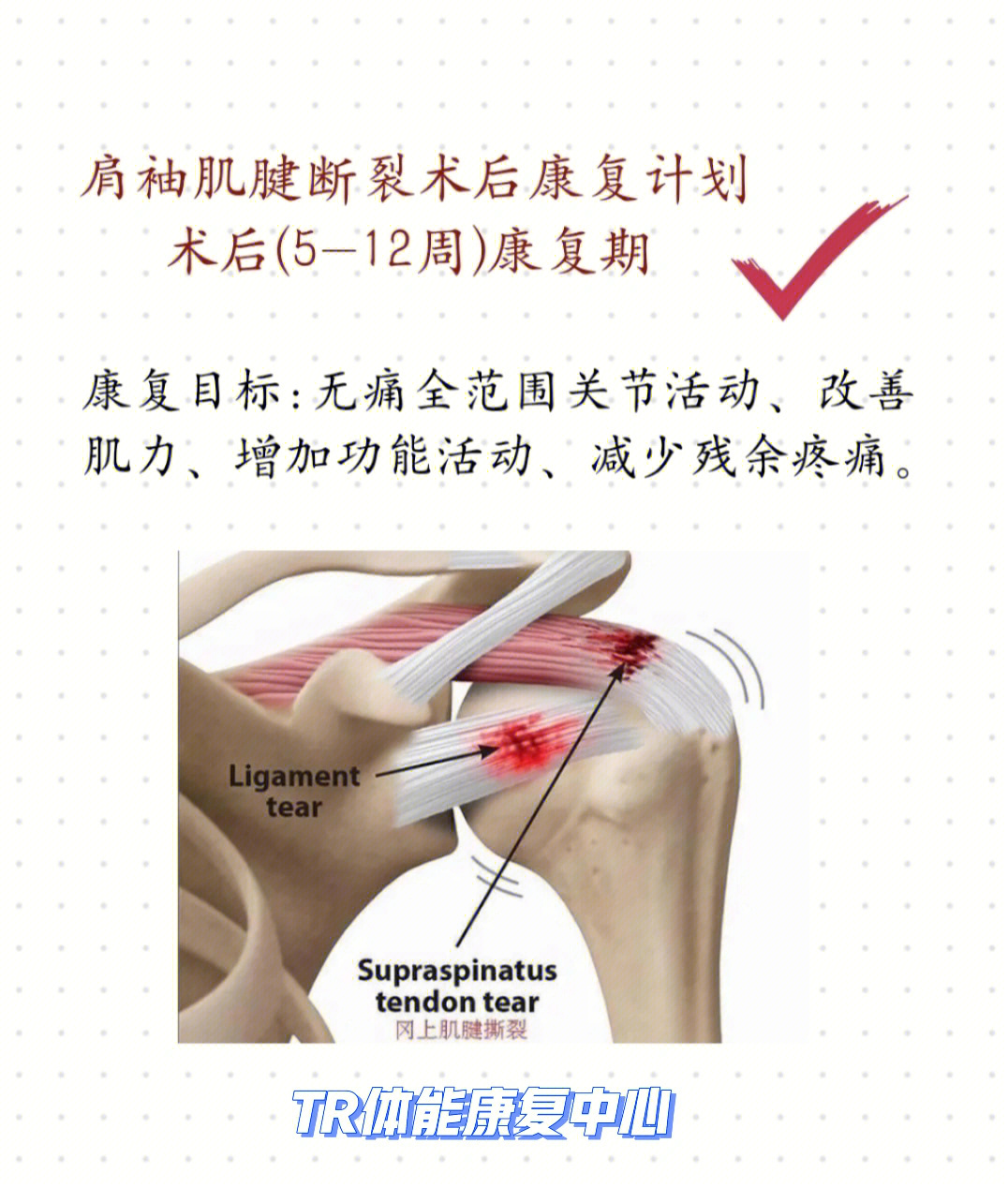 肩袖肌腱断裂术后康复训练计划512周