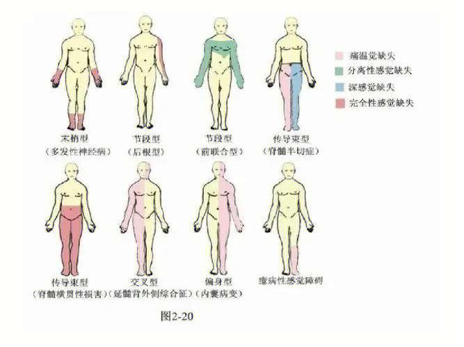 从零开始学神经病学11感觉障碍