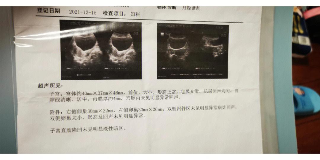 我这个促黄体生成素是不是有点高呀?我看人家都7