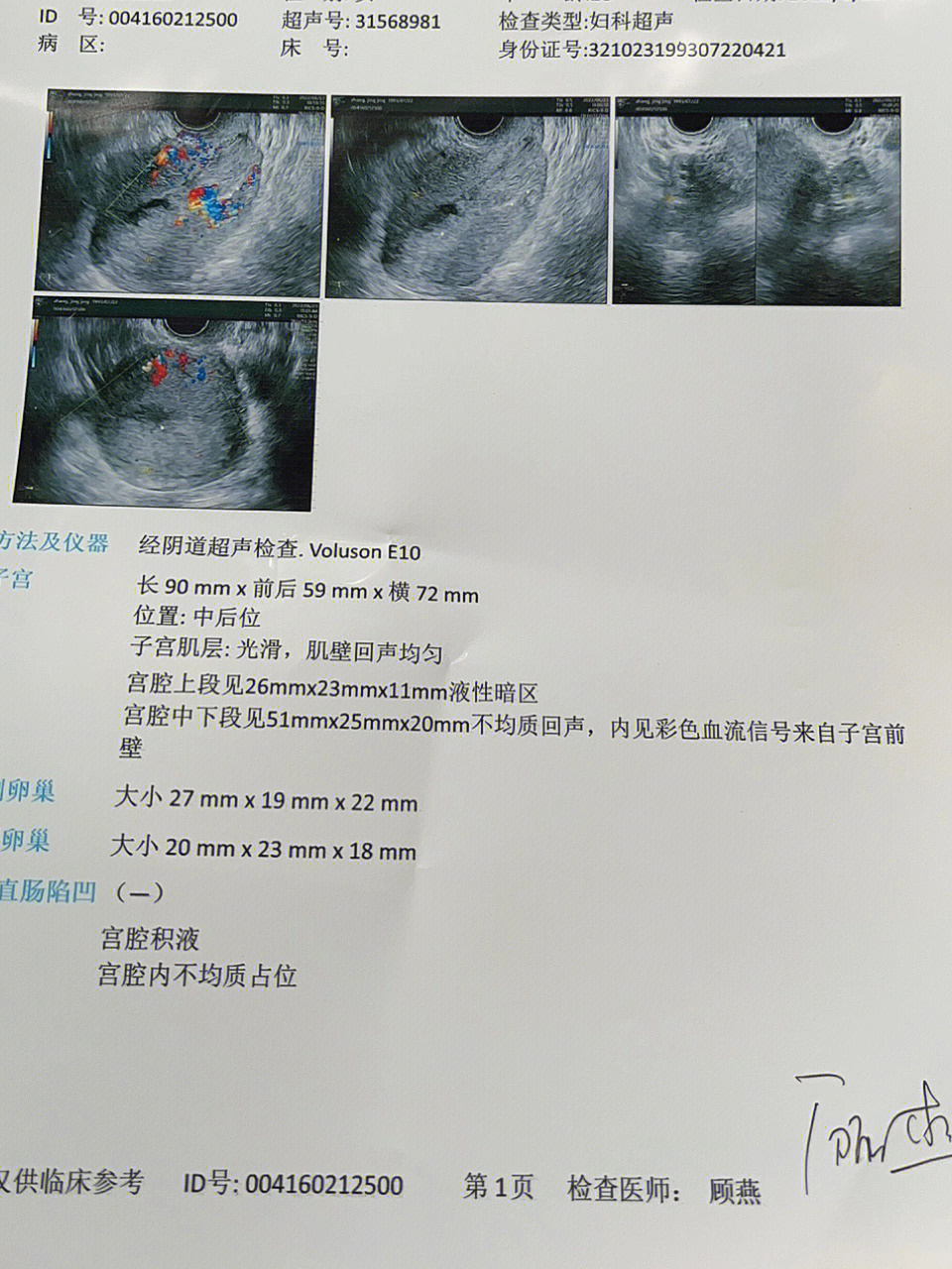 引产后血的颜色变化图图片