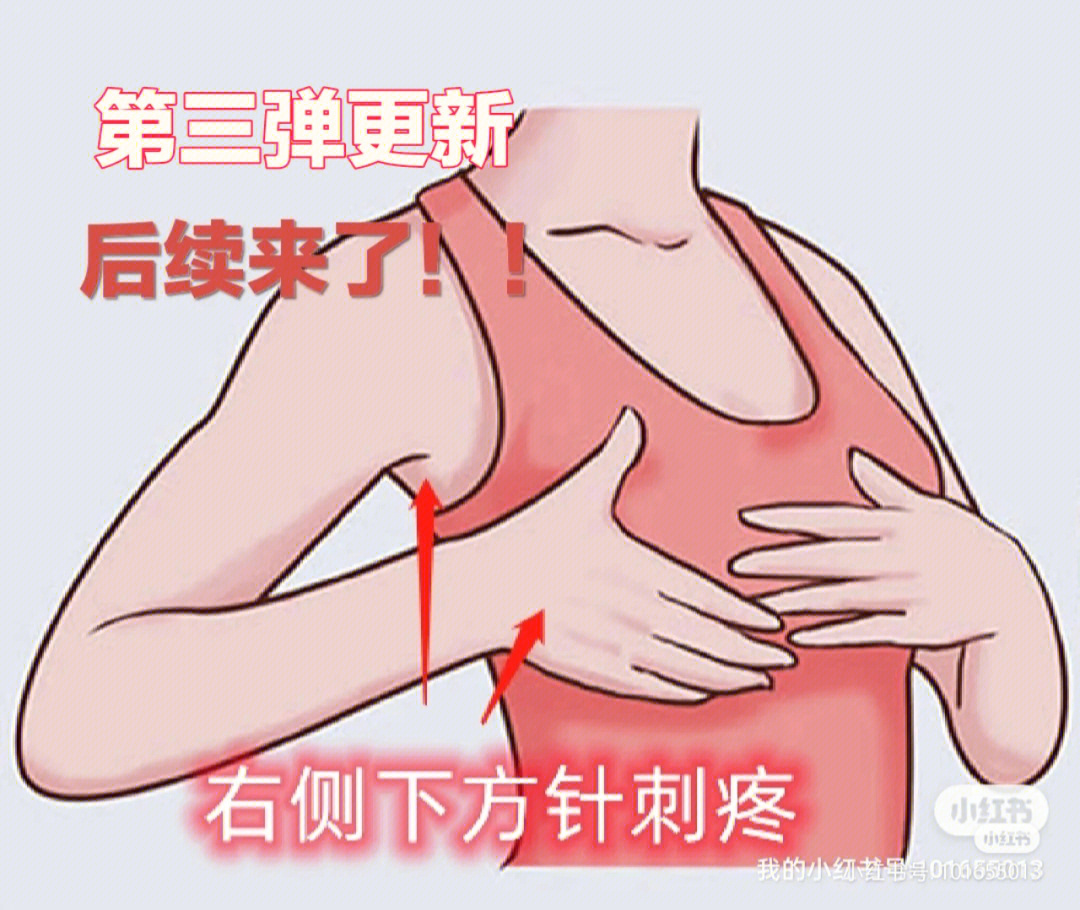 乳房疼痛连腋下后背疼图片
