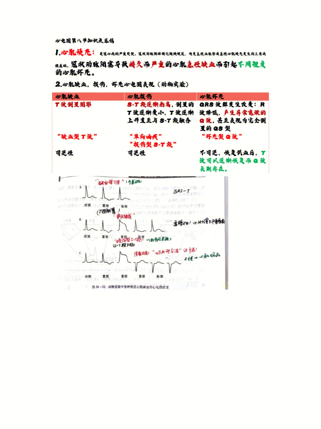 心得安心电图图片