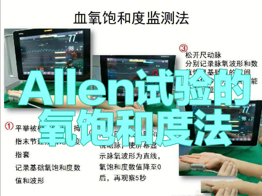 allen试验图片