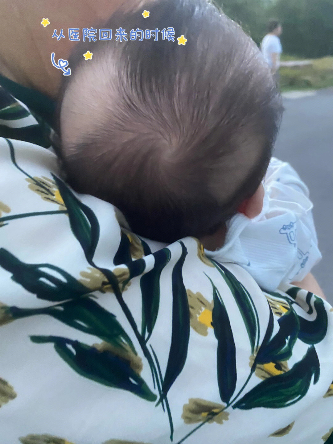 6月30第二个月体检,医生给宝宝剃了两块头发,好好的宝宝变成了小秃子