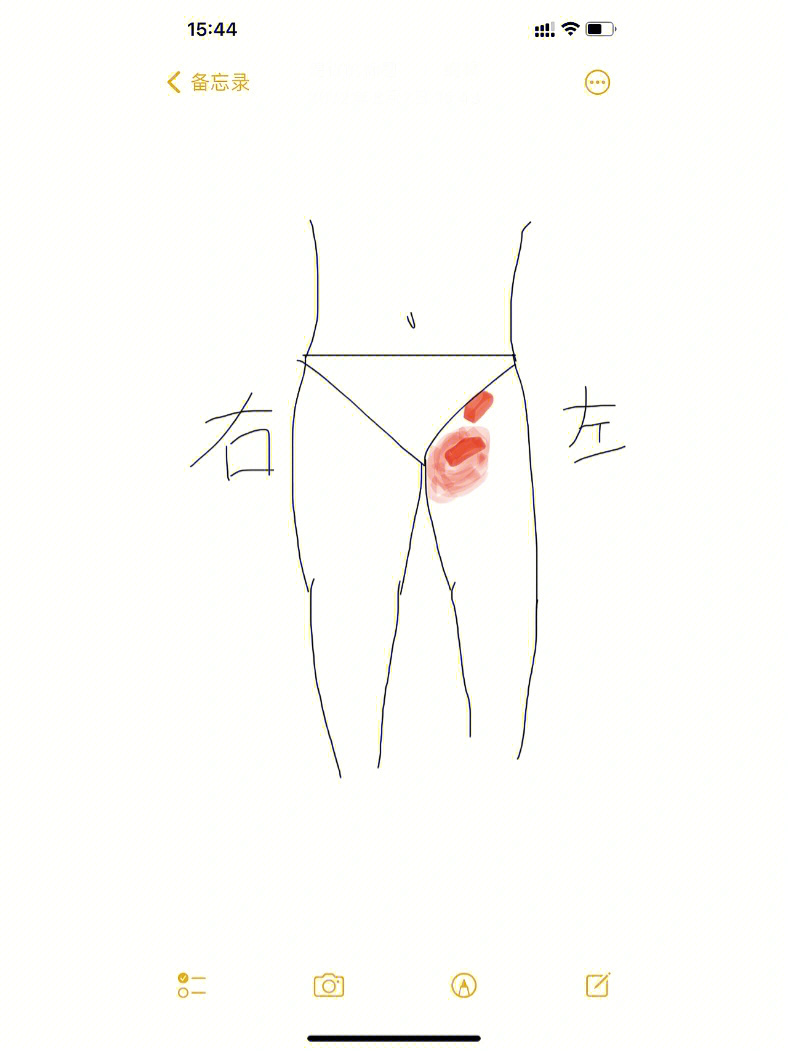 女性腹股沟疼痛图片