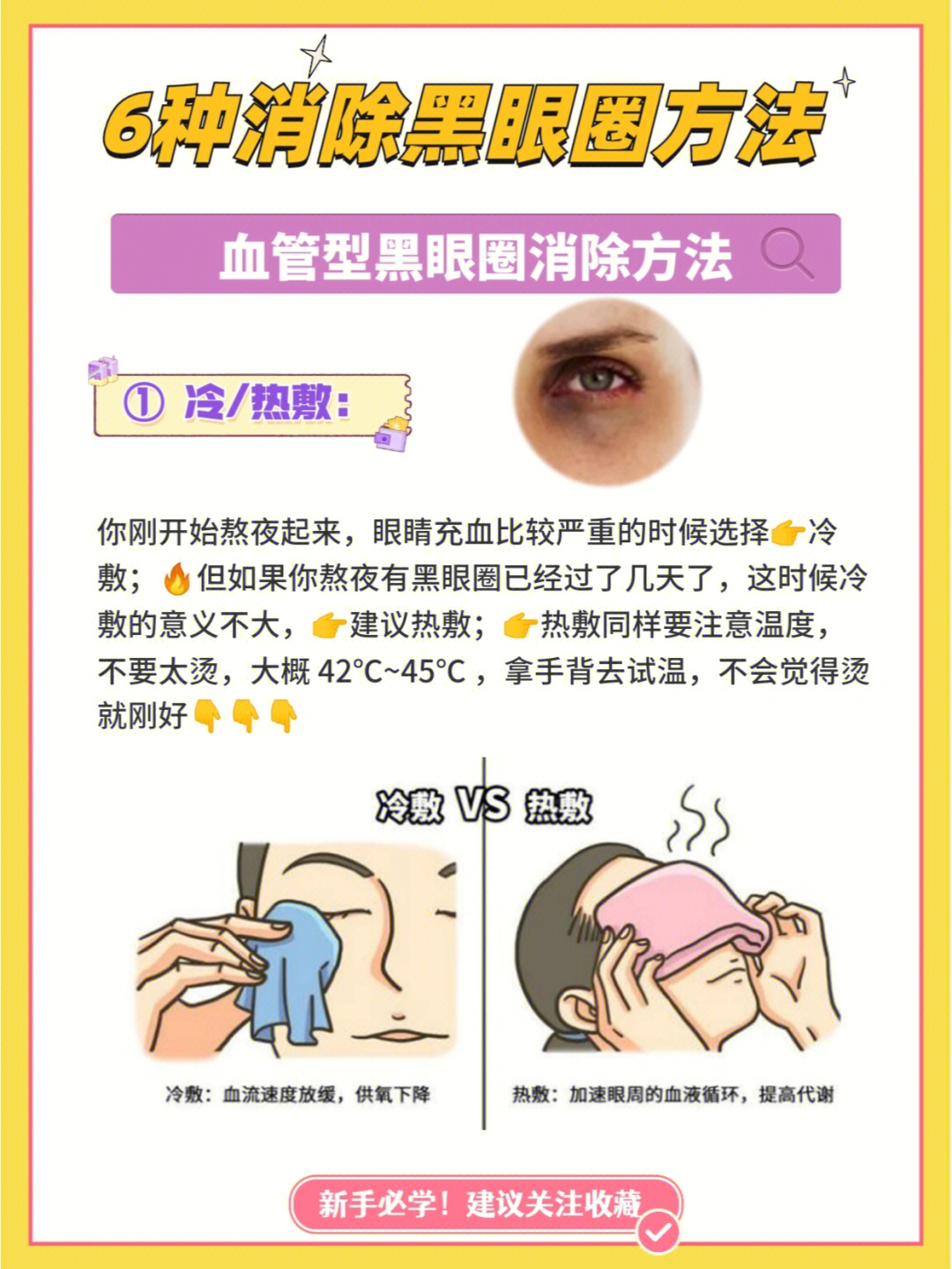 6种消除黑眼圈方法血管型黑眼圈消除法