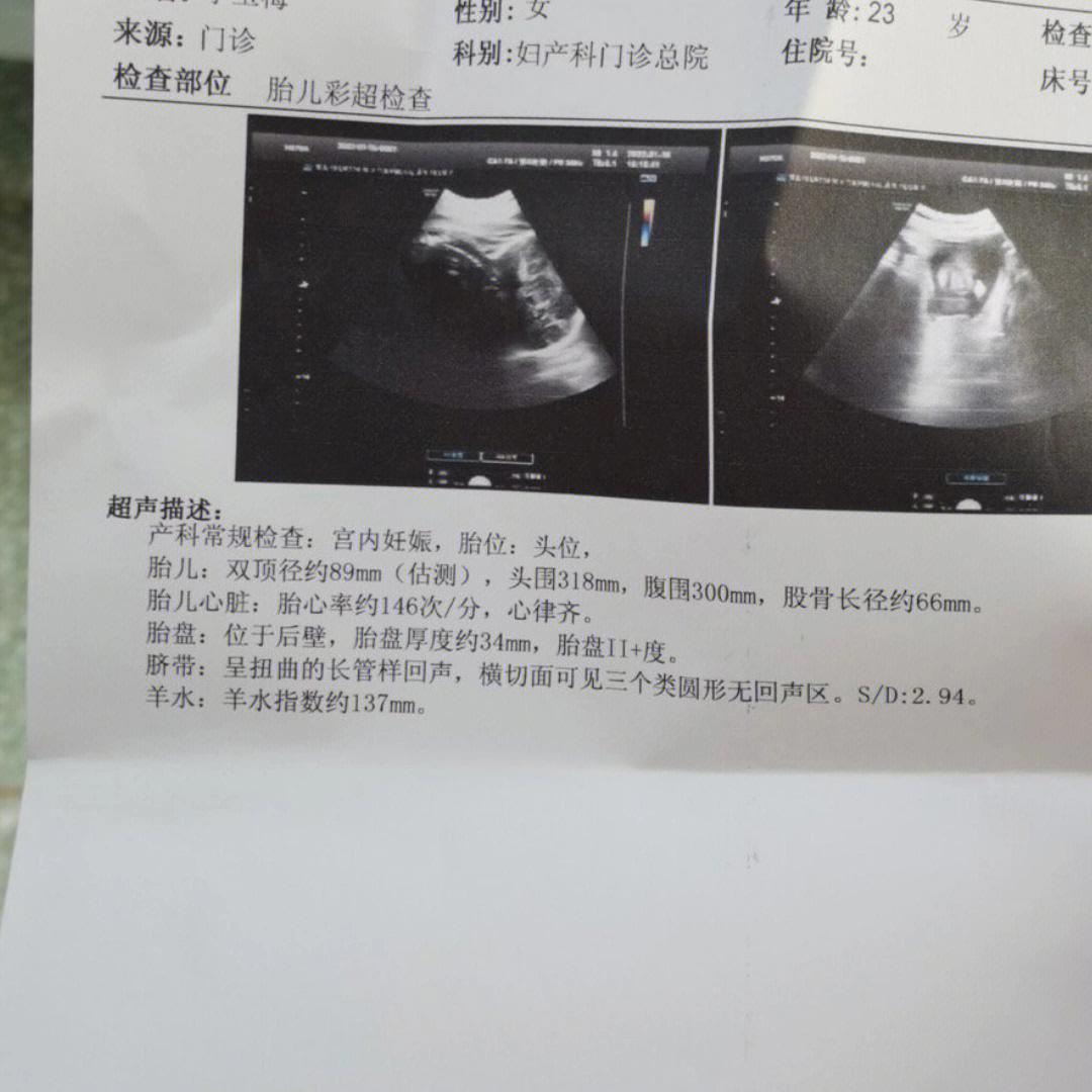 胎儿36周发育标准数值图片