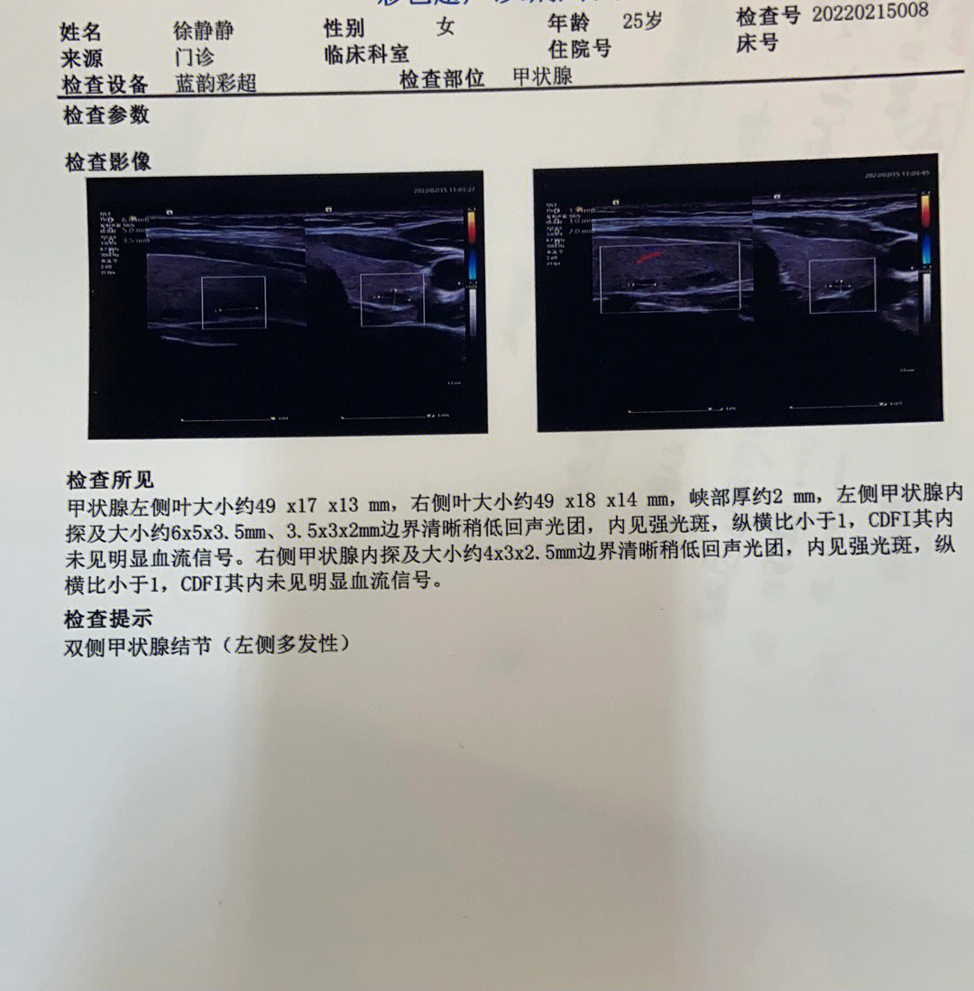 正常甲状旁腺超声图片图片