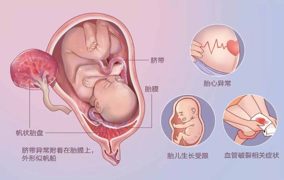 胎盘图片胎儿子宫图片