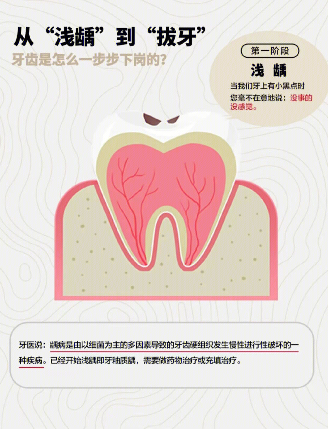 蛀牙随着时间推移,会不断蛀深,应及时处理