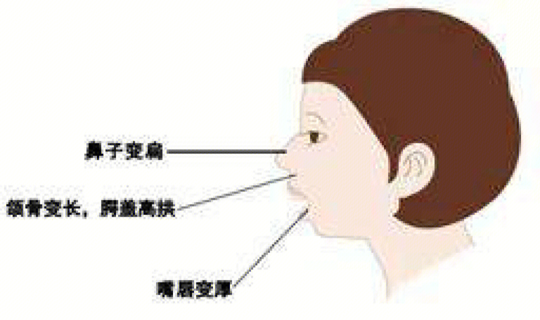 下肢伸侧和屈侧示意图图片