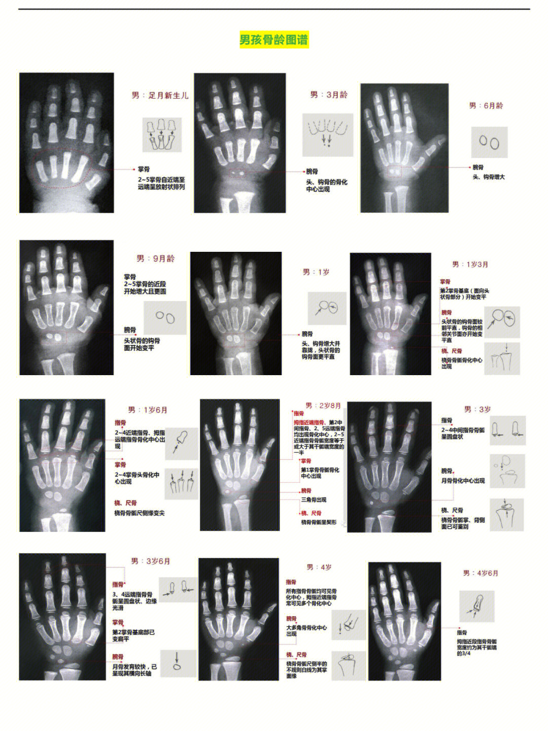 务必收藏丨最全骨龄图谱方便随时对照