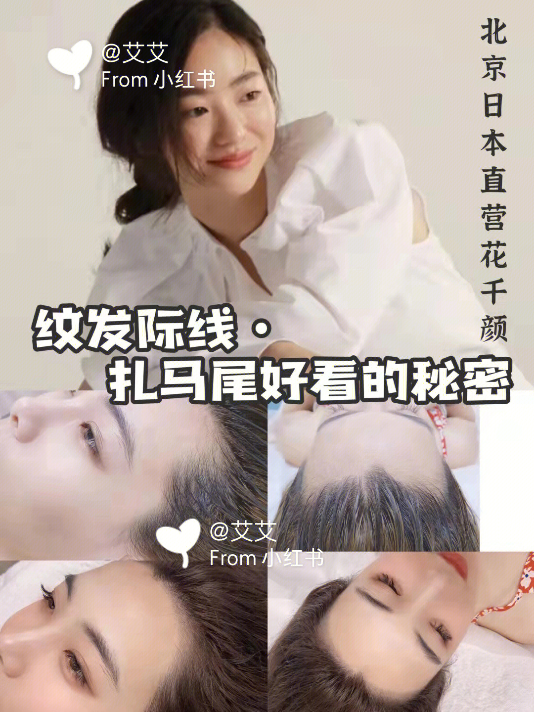 不做秃头女孩北京纹发际线北京花千颜走