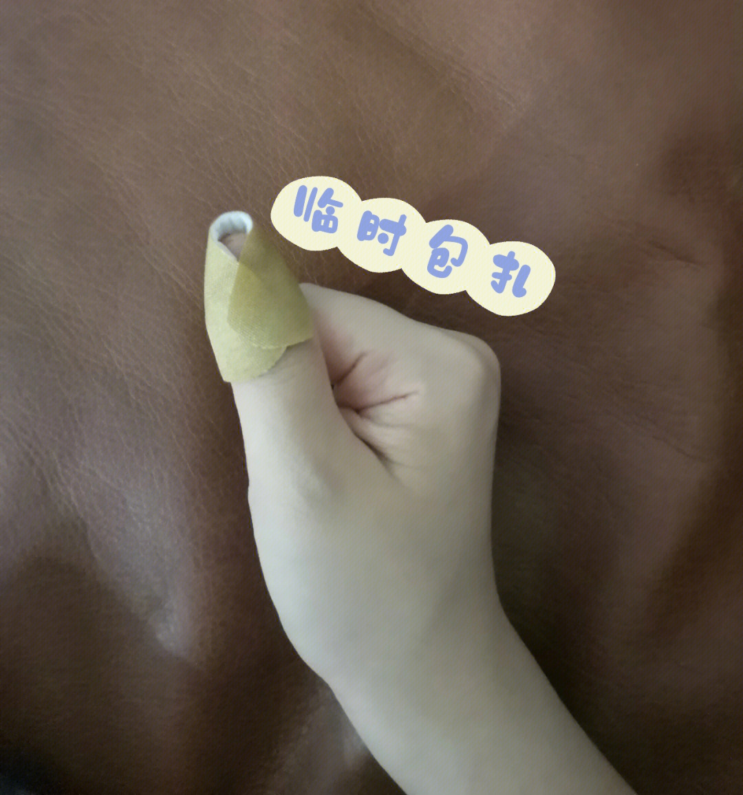 儿童手指包扎方法图解图片