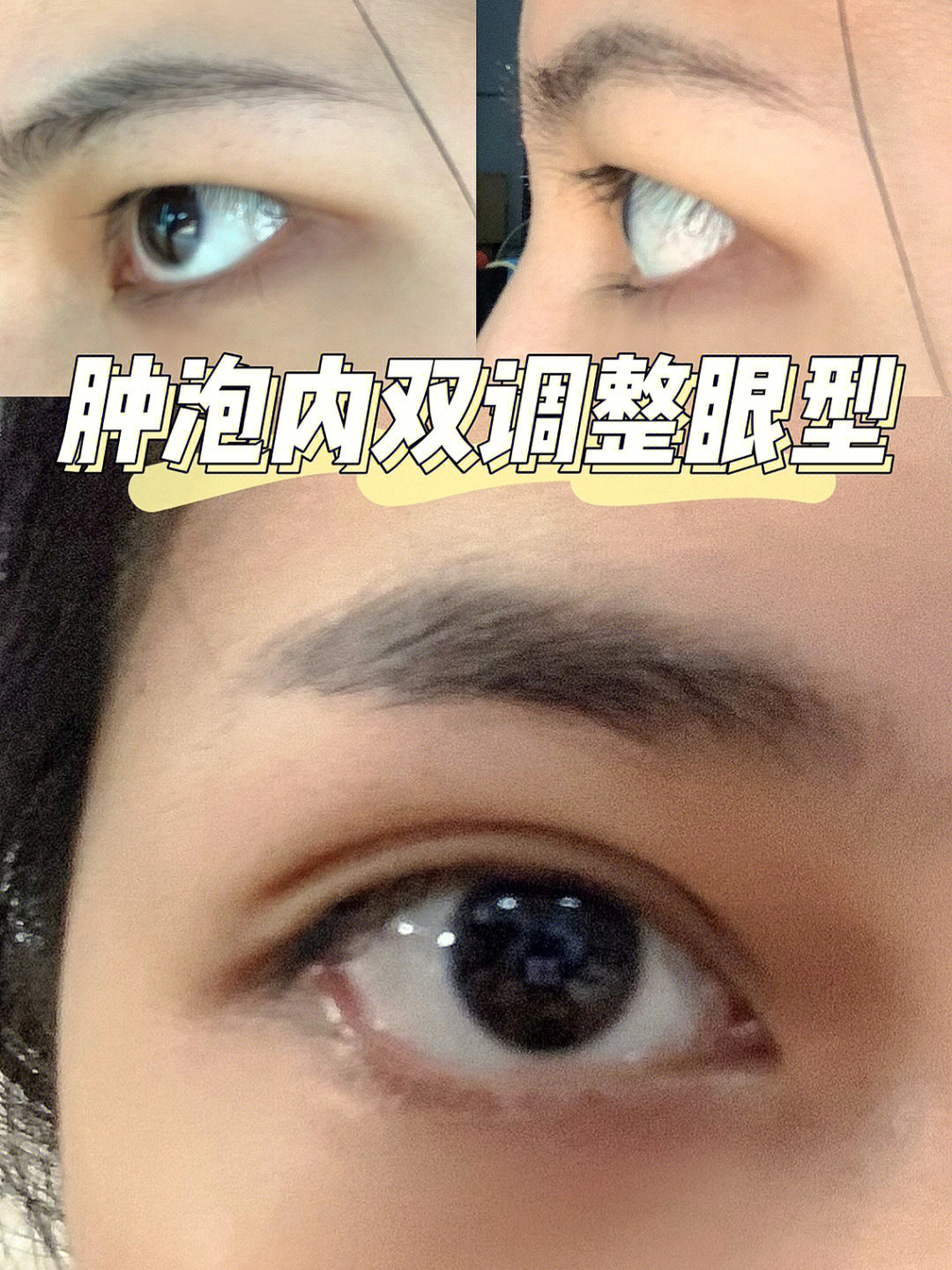 如果你也是肿泡眼77内双