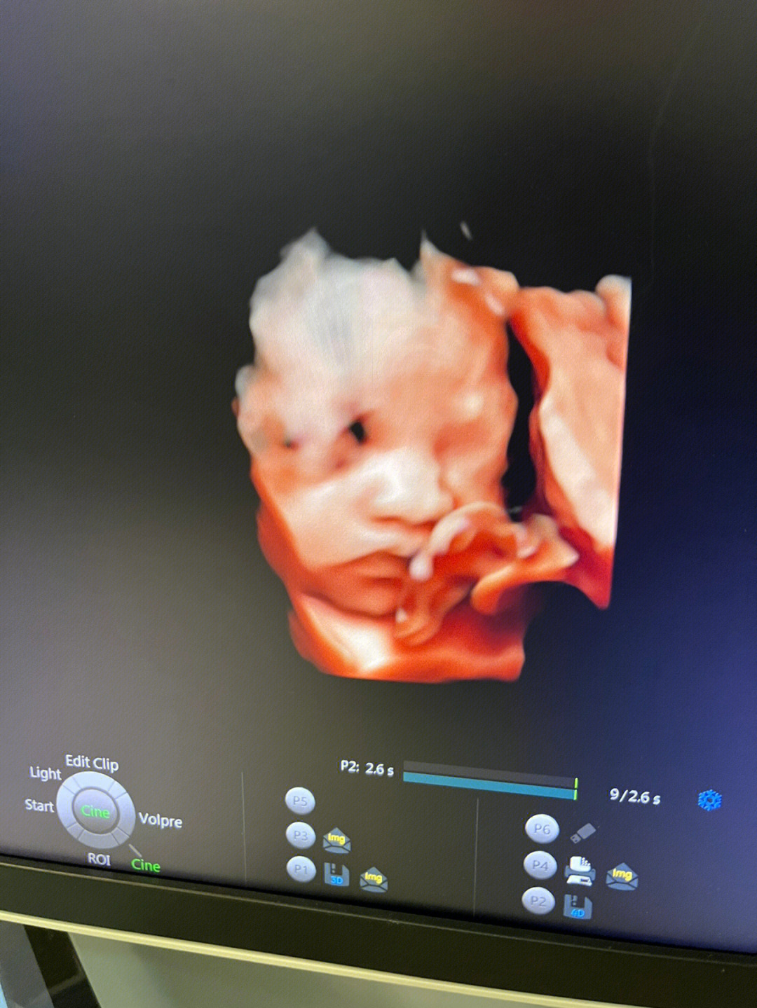 孕30周宝宝图片图片