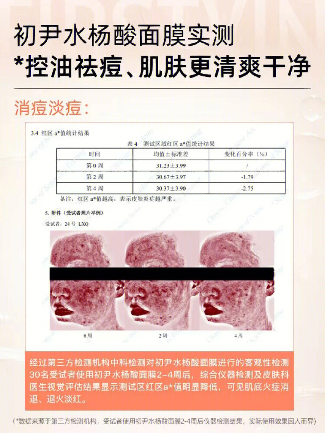 水杨酸面膜实测控油淡痘养成清爽肌肤