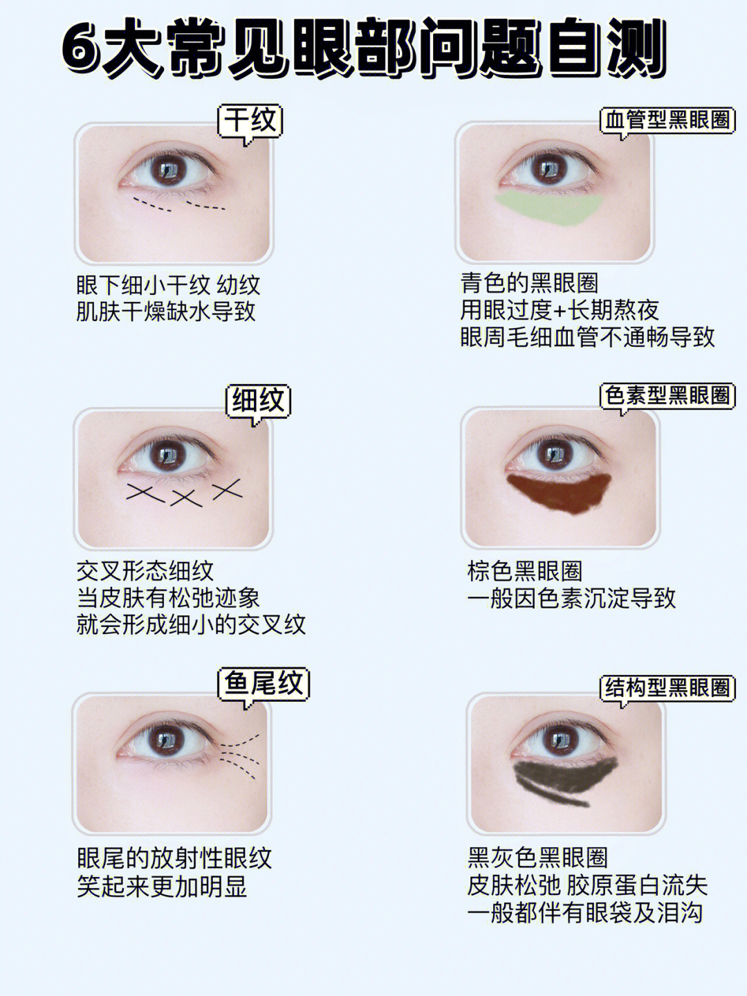 6种常见眼部肌肤问题自测眼部抗初老干货