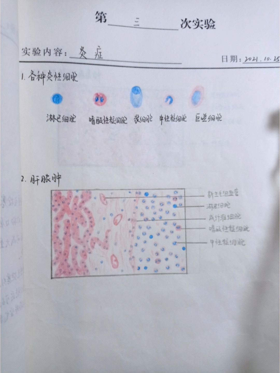 肝脓肿红蓝铅笔绘图图片