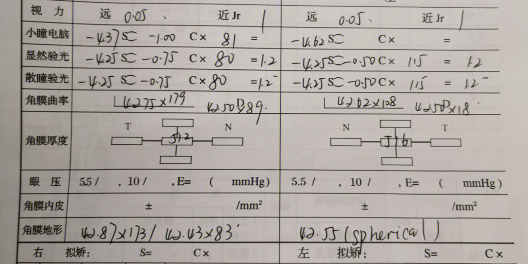 哪位大神可以帮我看看,我是否适合做近视手术,还有暗瞳值05