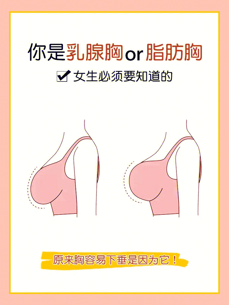 乳腺胸和脂肪胸区分图图片