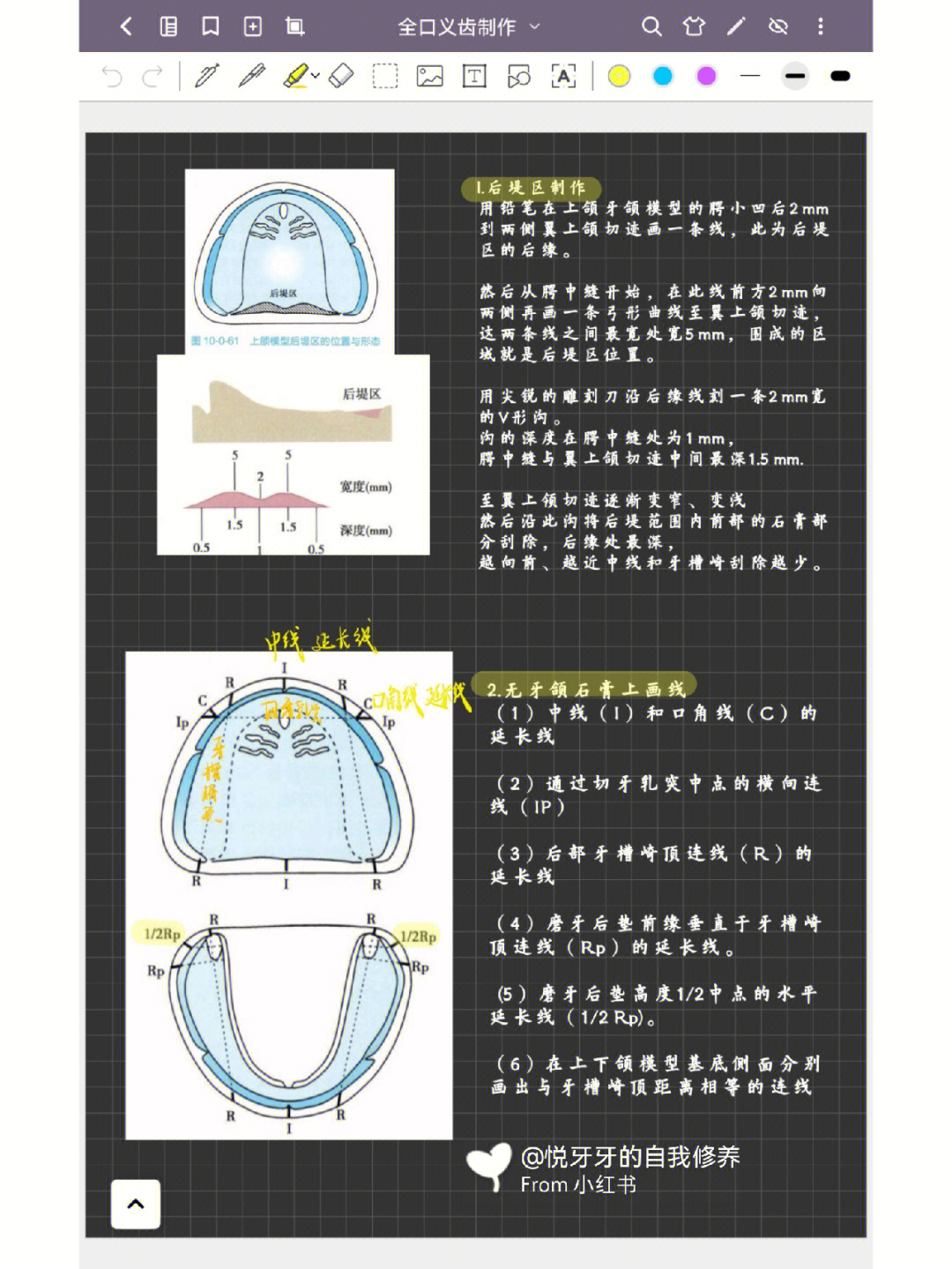 上颌后堤区的位置图片图片