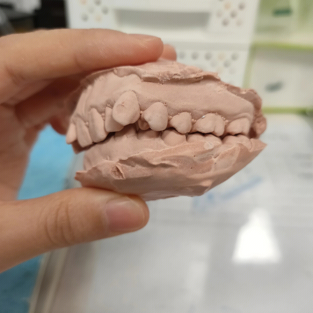正常牙齿咬合图 模型图片