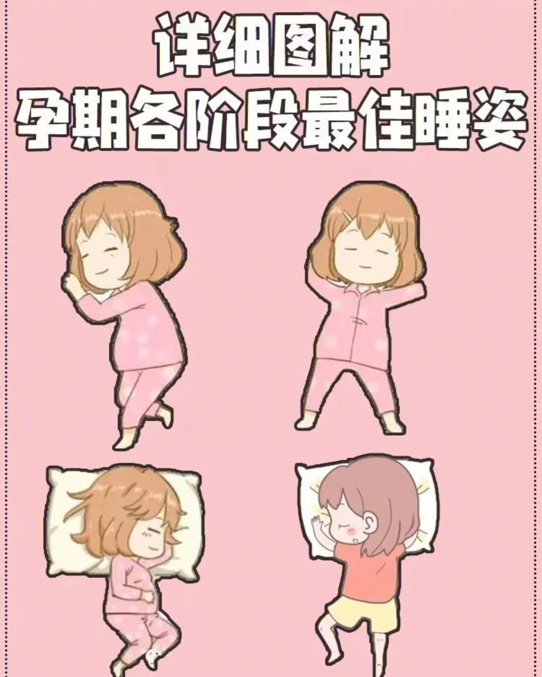 侧俯卧位睡眠示意图图片