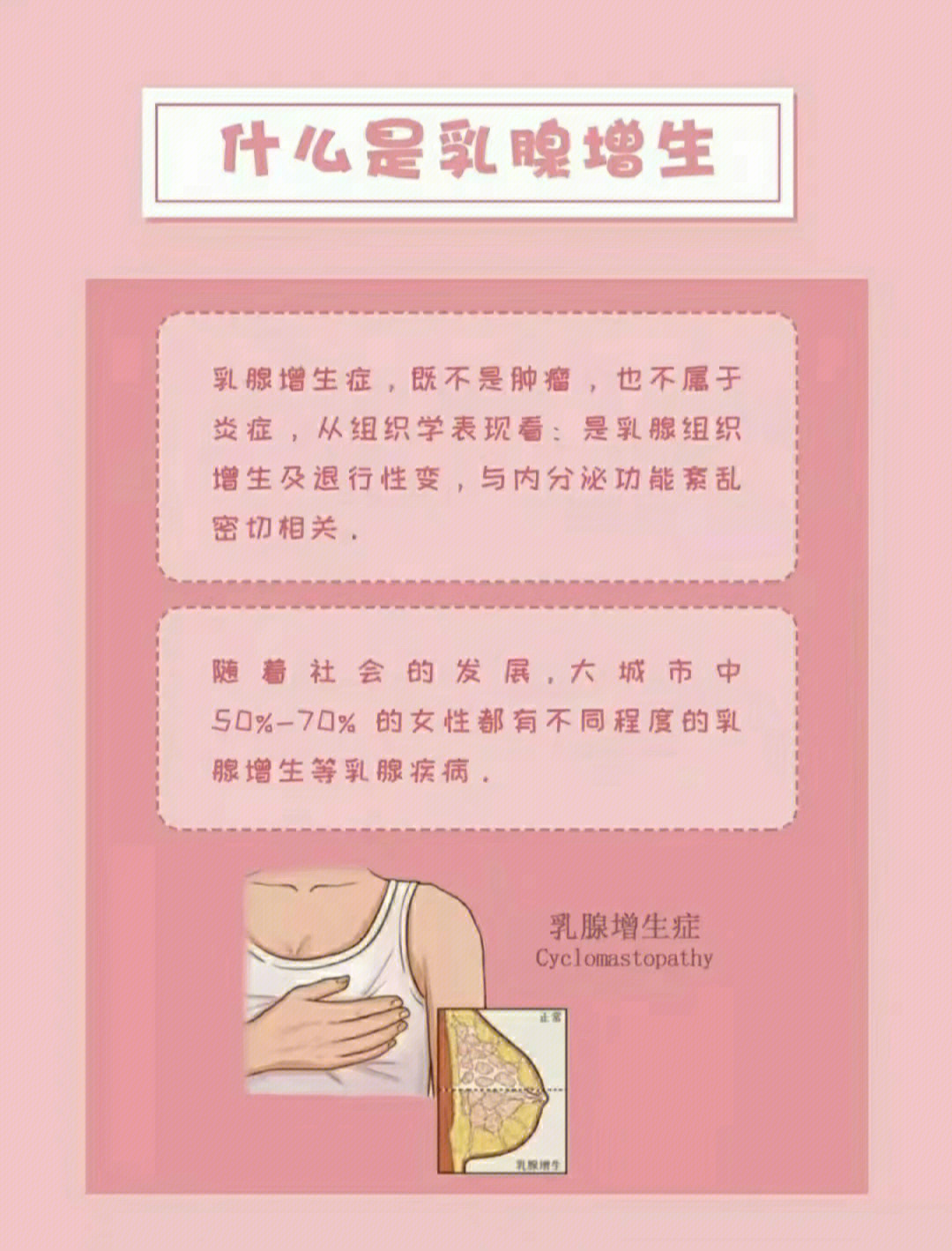 健康小科普:什么是乳腺增生?