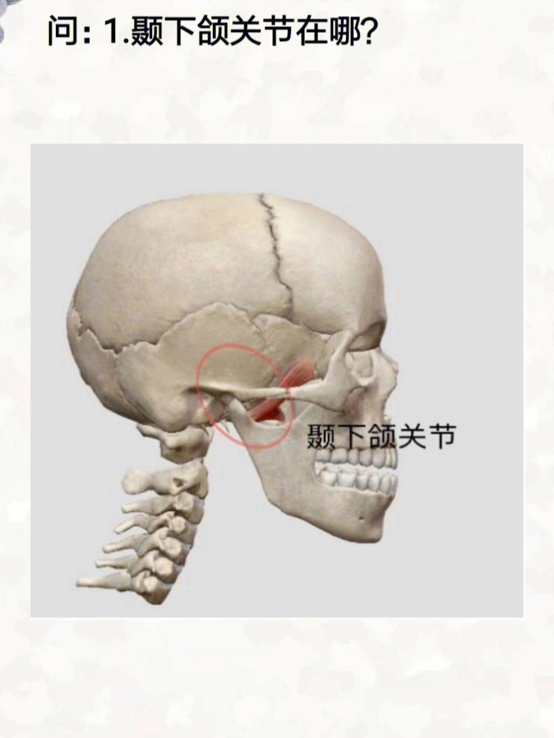 颞下颌关节有弹响92张口过大时, 颞下颌关节被卡住92开/闭口困难