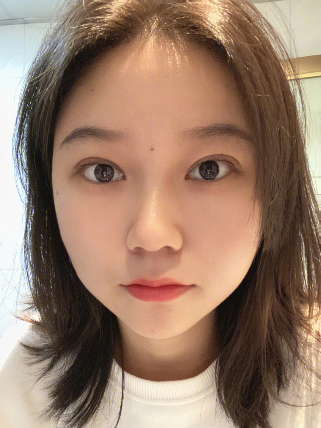 韩式三点式双眼皮效果图片