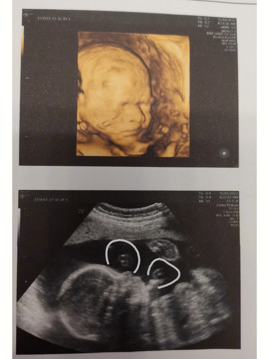 怀孕24周宝宝多大图片图片