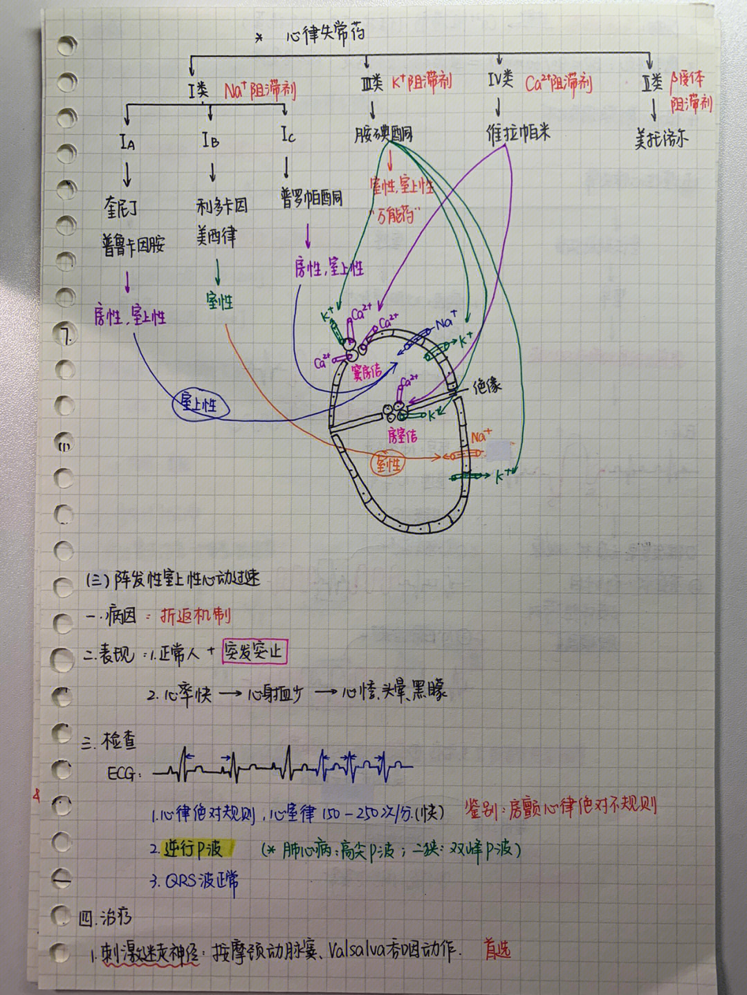 阵发性室上速,室性心动过速,房室传导阻滞