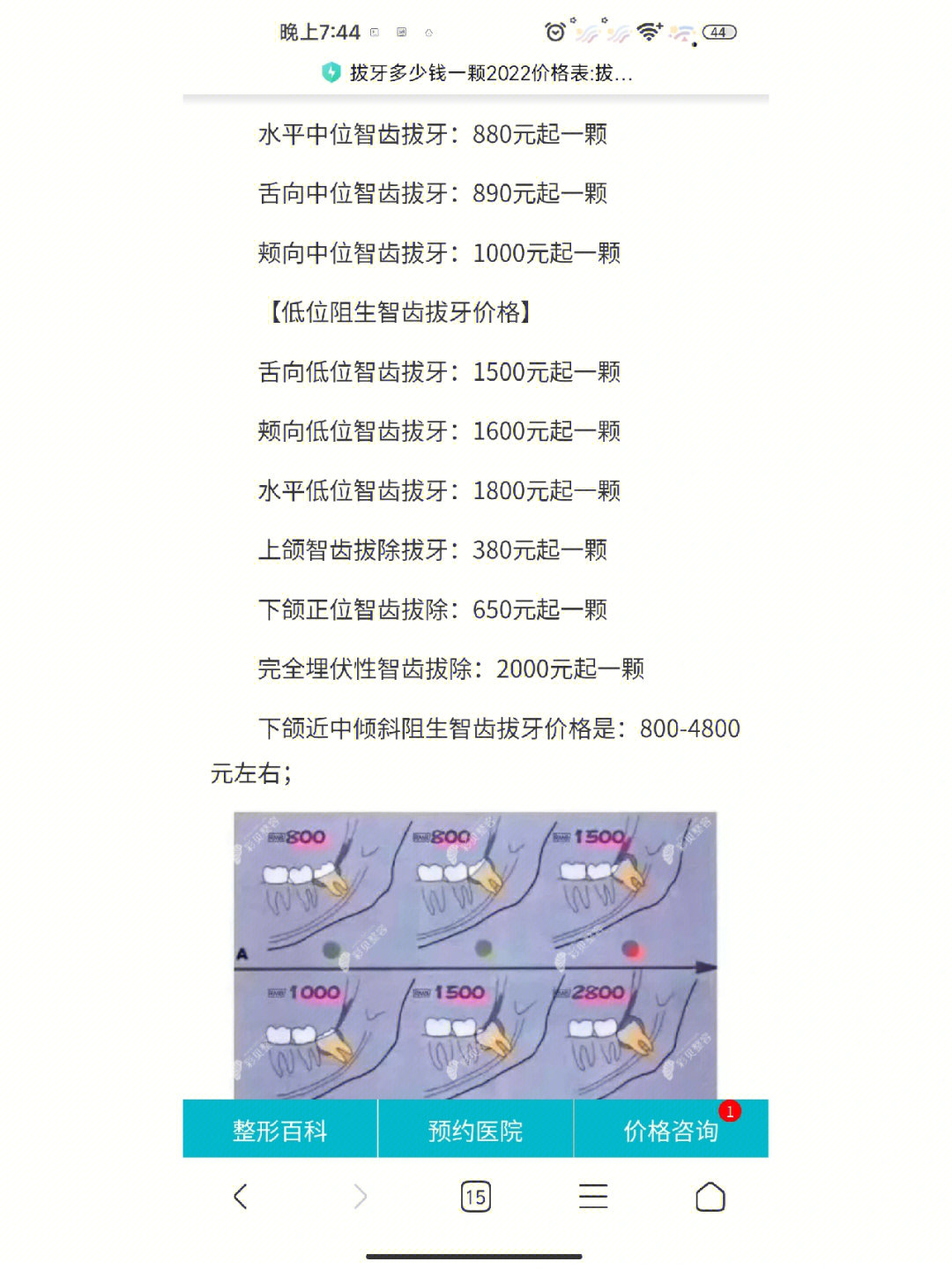 多生牙拔牙多少钱图片