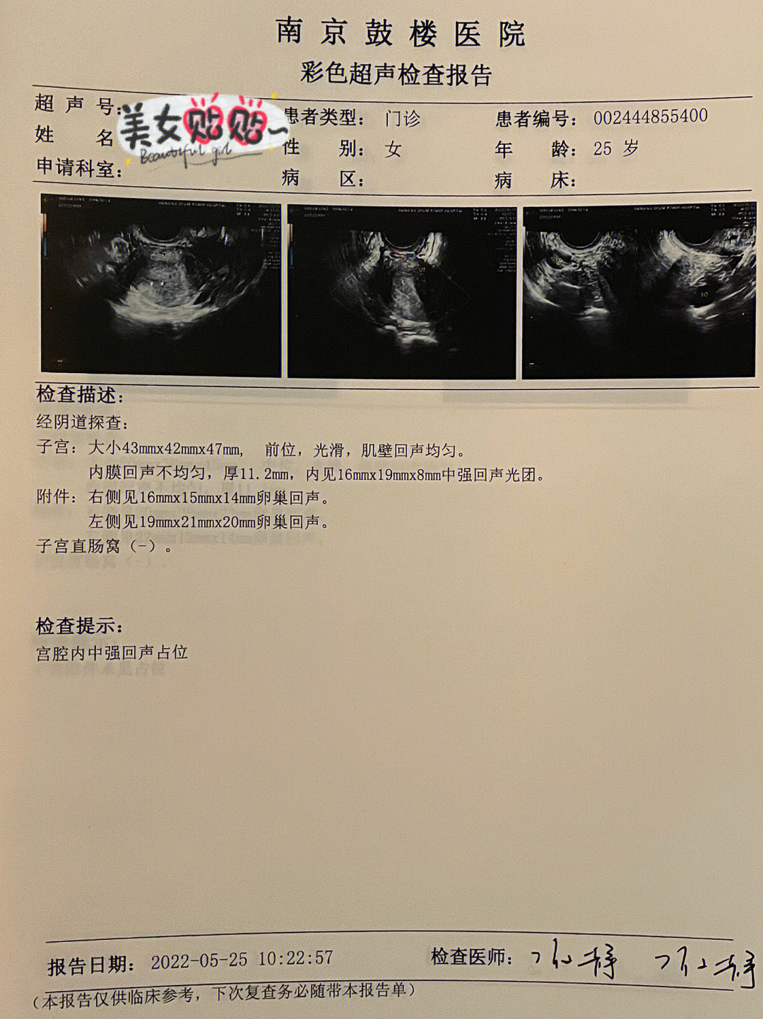 子宫内膜癌诊刮物图片图片