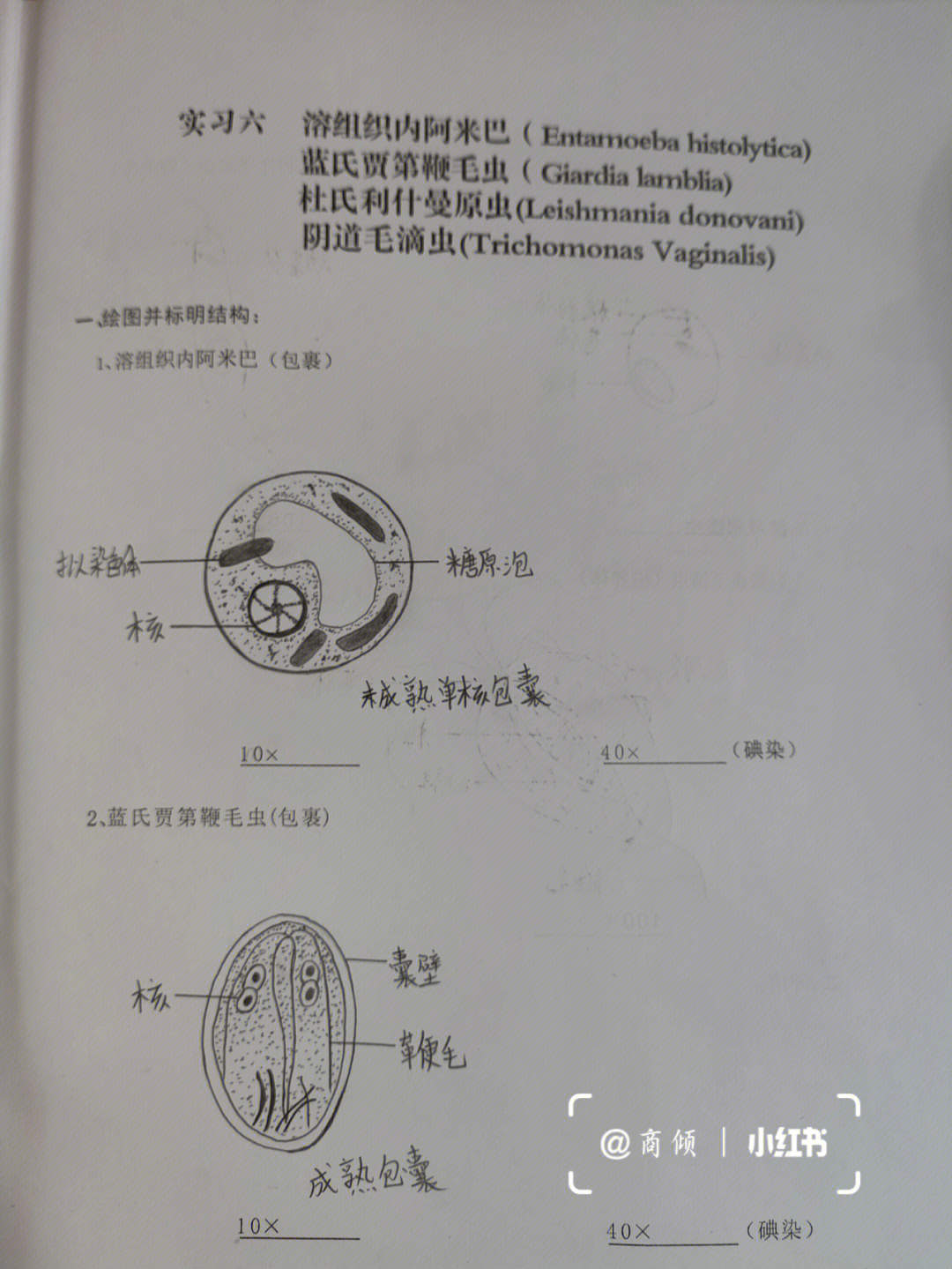 斯氏狸殖吸虫卵手绘图图片