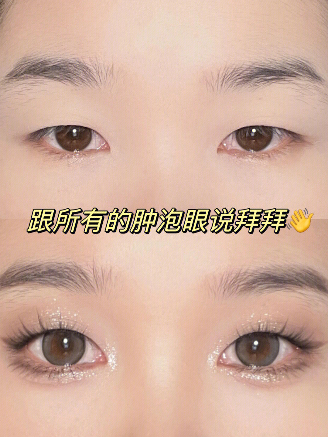 跟所有的肿泡眼说拜拜开启手动大眼