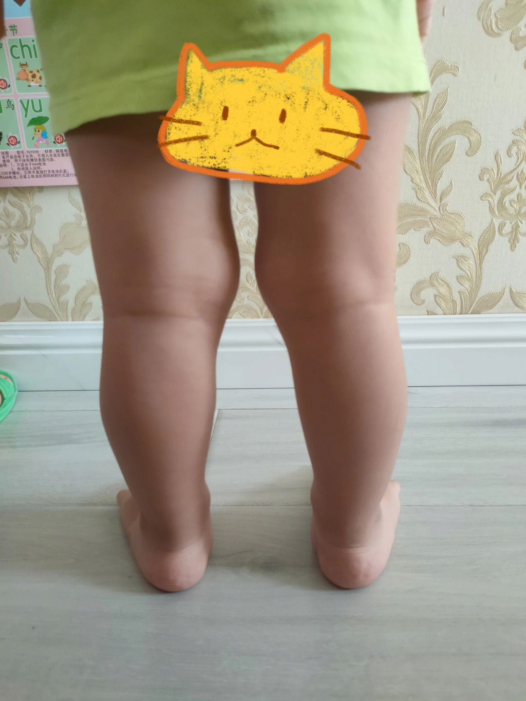 这是x型腿吗2岁