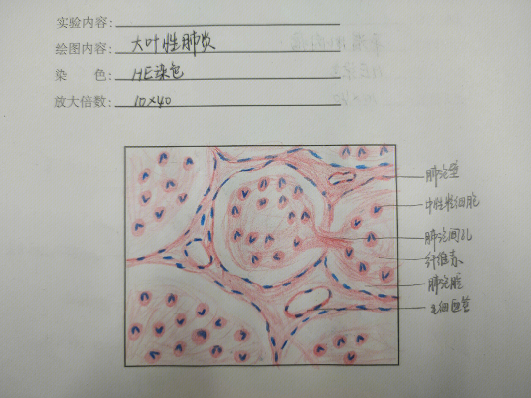 呼吸系统红蓝铅笔绘图