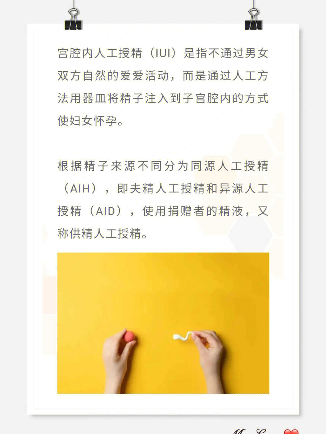 人工授精疼不疼女性图片