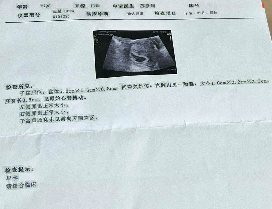 今天去医院官宣啦纪念一下小baby的第一张照片不满七周已经有胎心胎芽