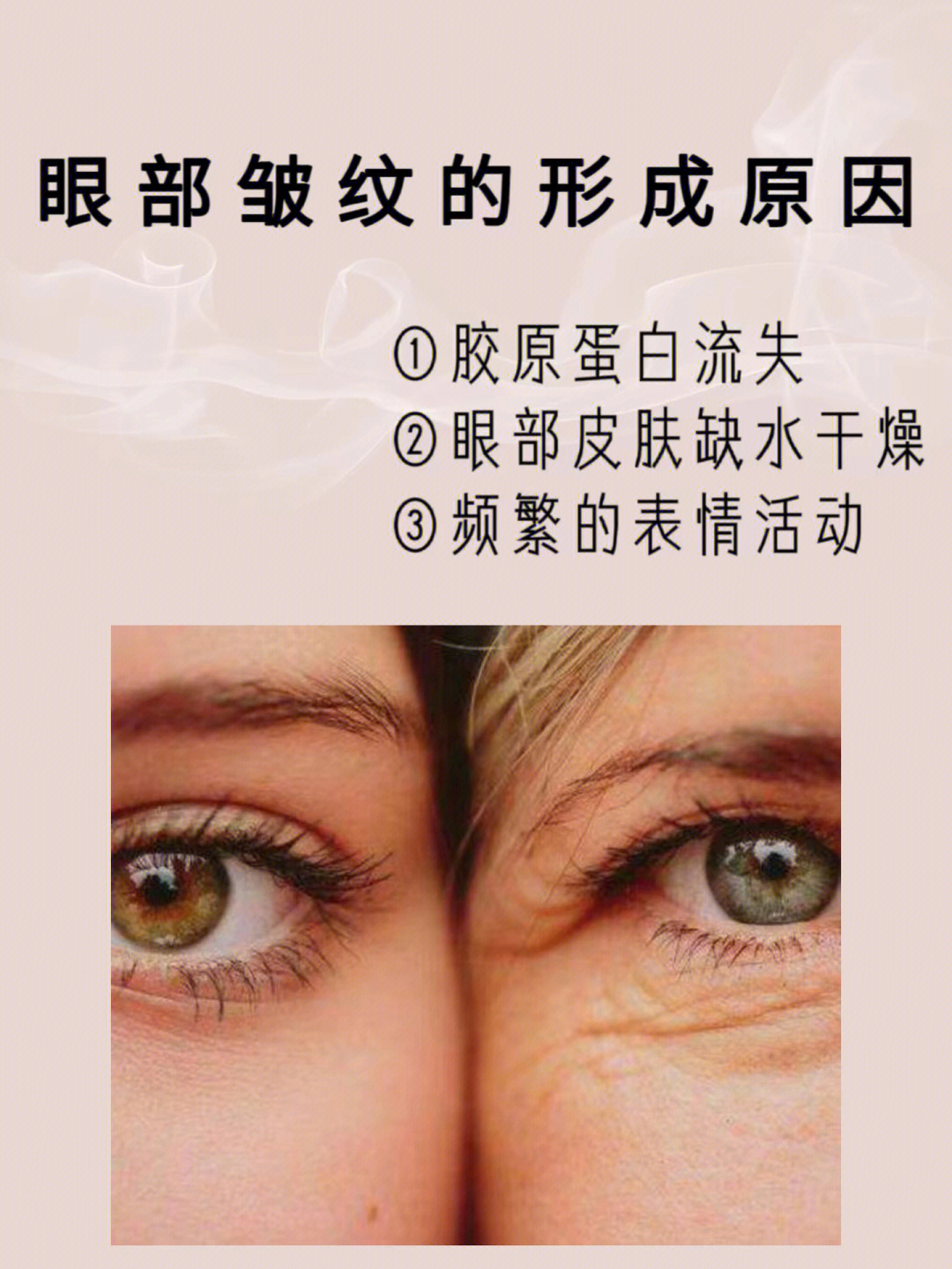 眼部皱纹