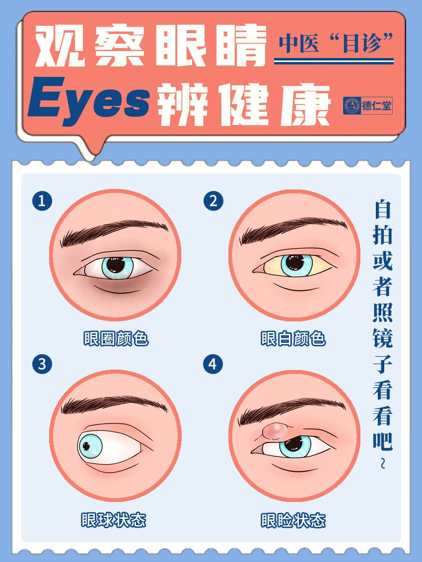 老中医教你看眼睛辨健康预防大小病未病