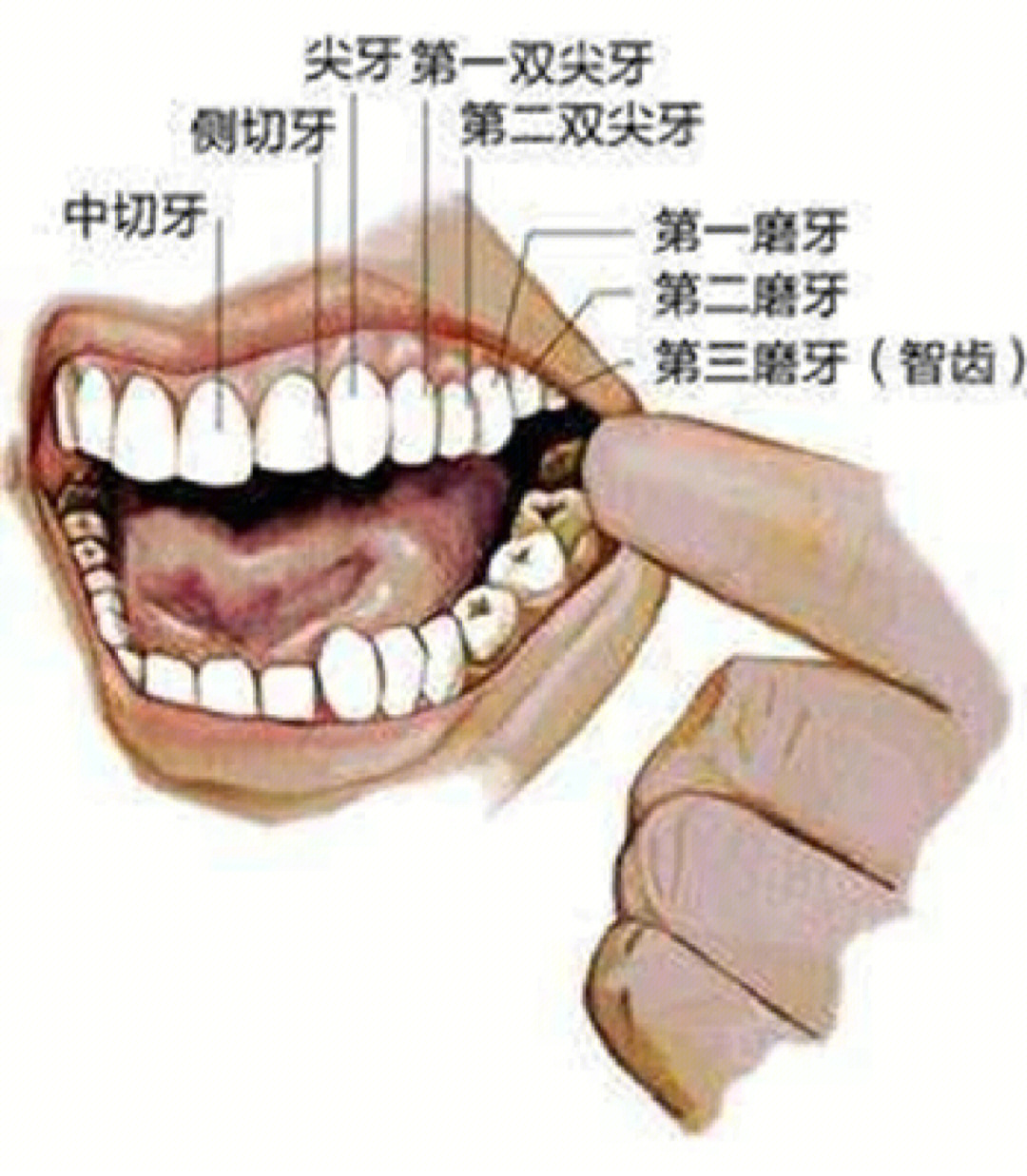 智齿要不要拔有讲究