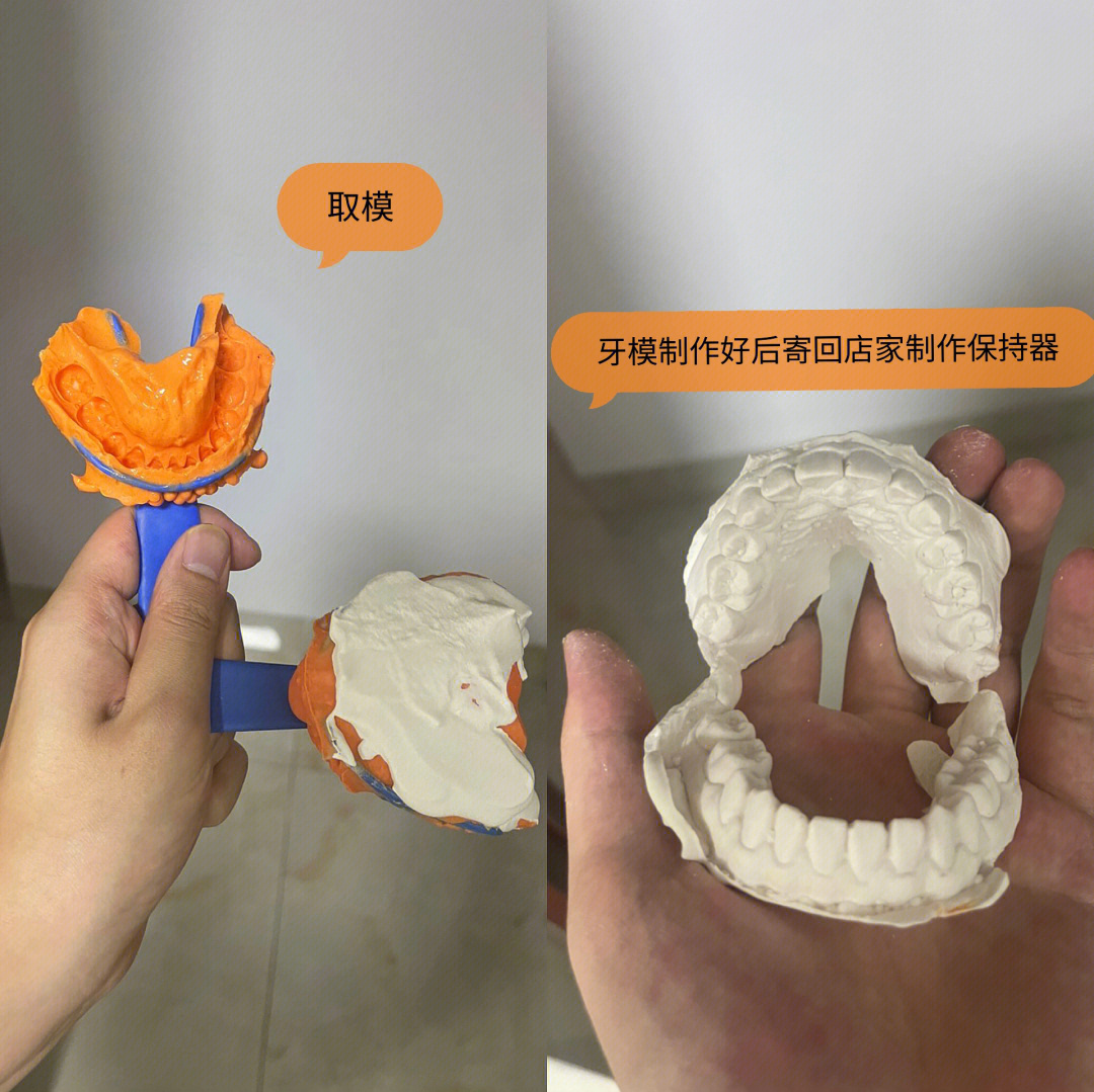 压膜保持器的制作过程图片