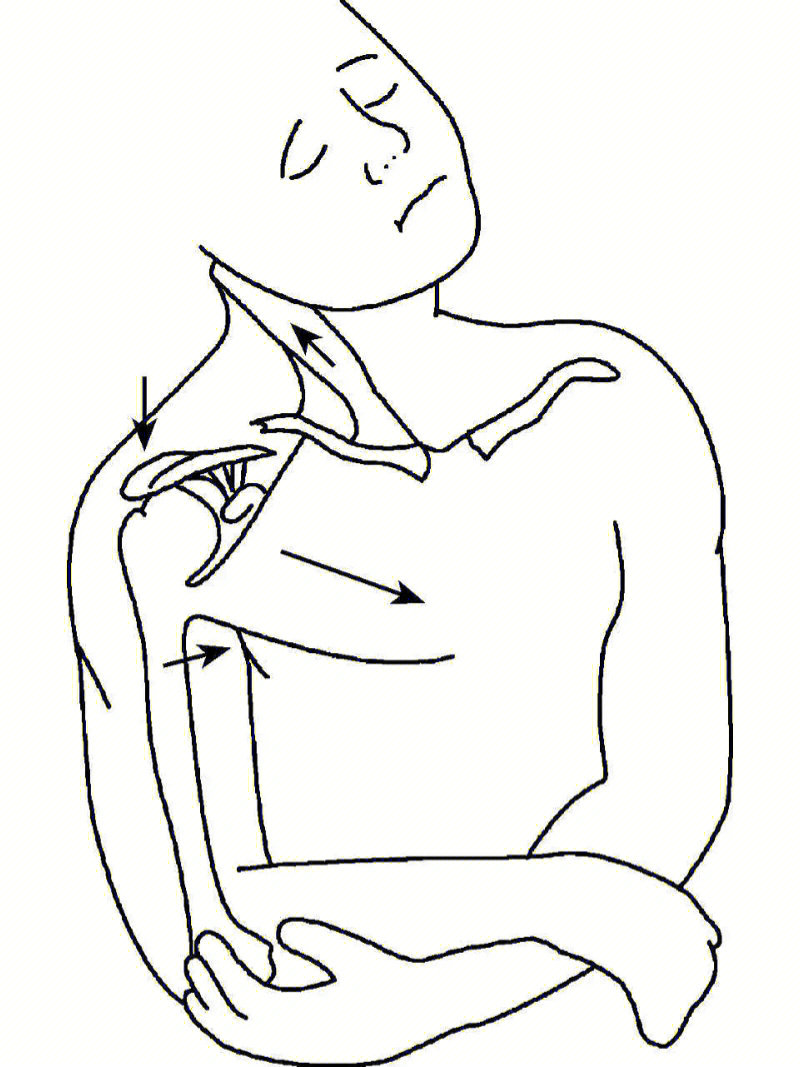 (保守治疗)包括多种方法,如对患肢简单悬吊的颈腕吊带,吊带辅以绷带,8