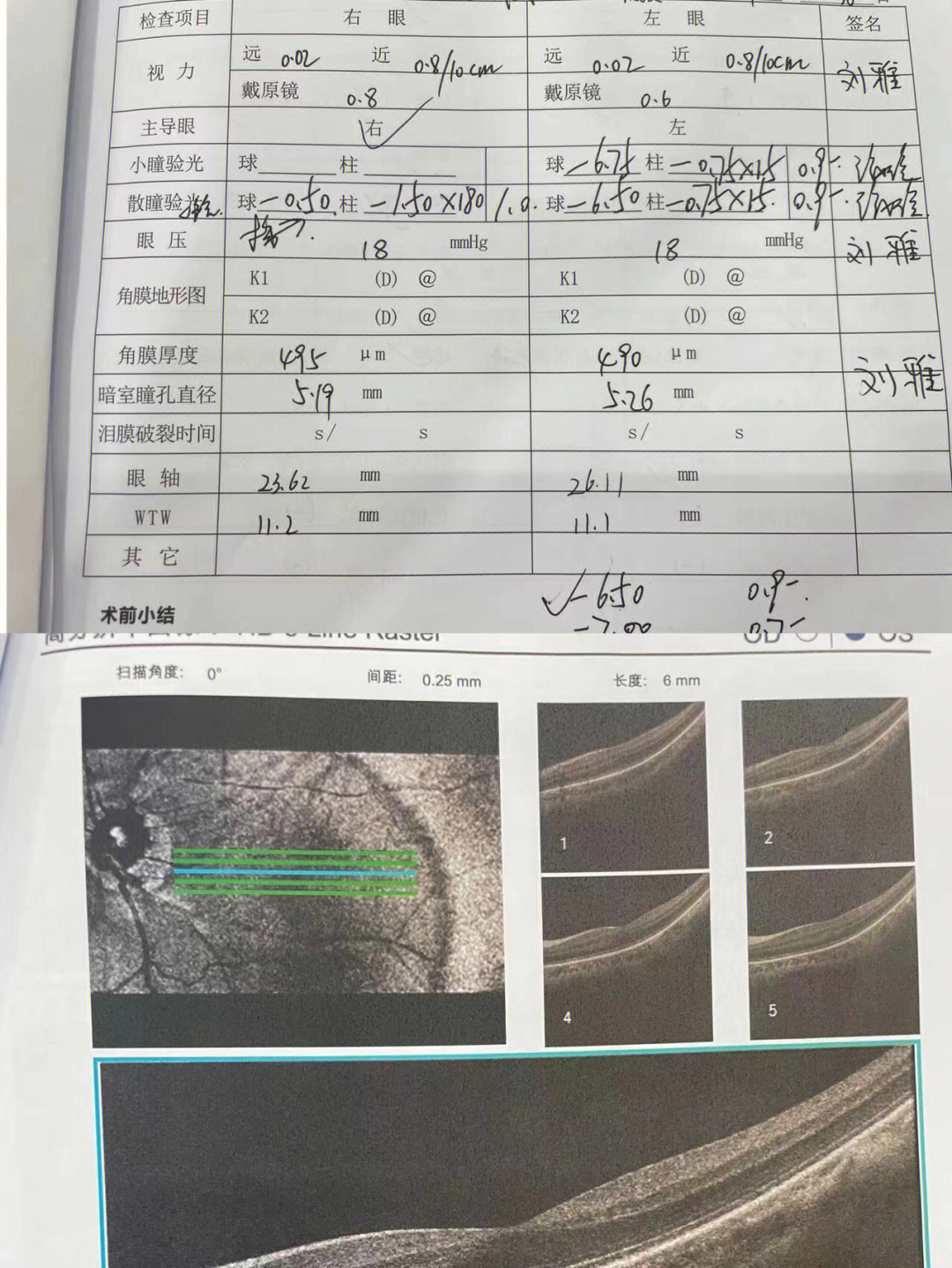 正常的眼科视野报告图图片