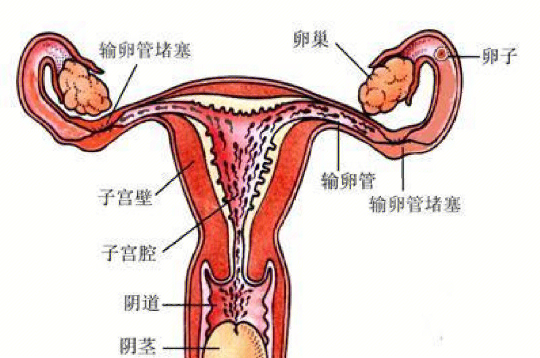 阑尾和卵巢的位置图图片